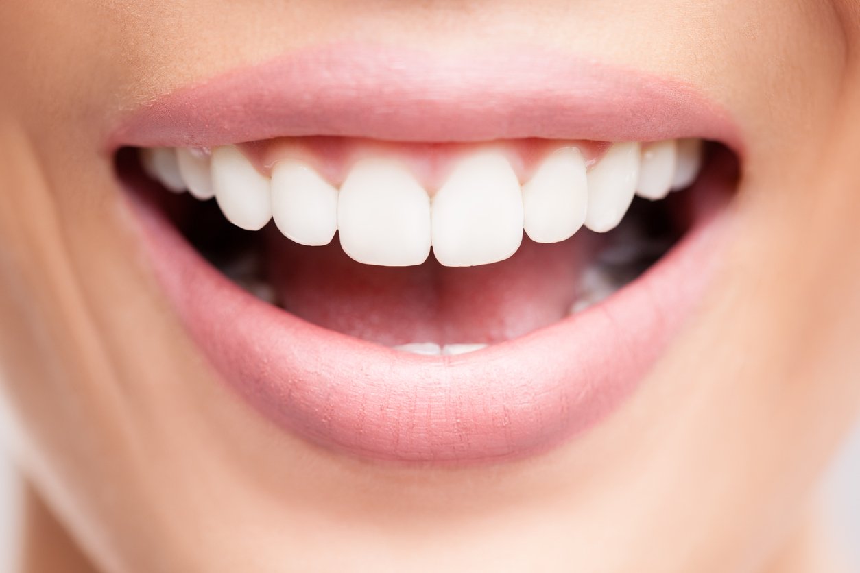 Différence entre dents naturelles et blanchies