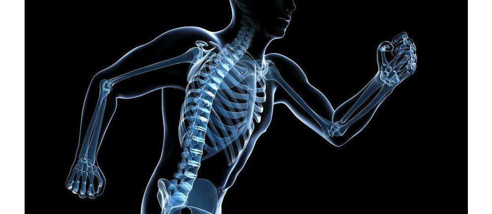 Radiographie médicale montrant la structure osseuse d'une hanche