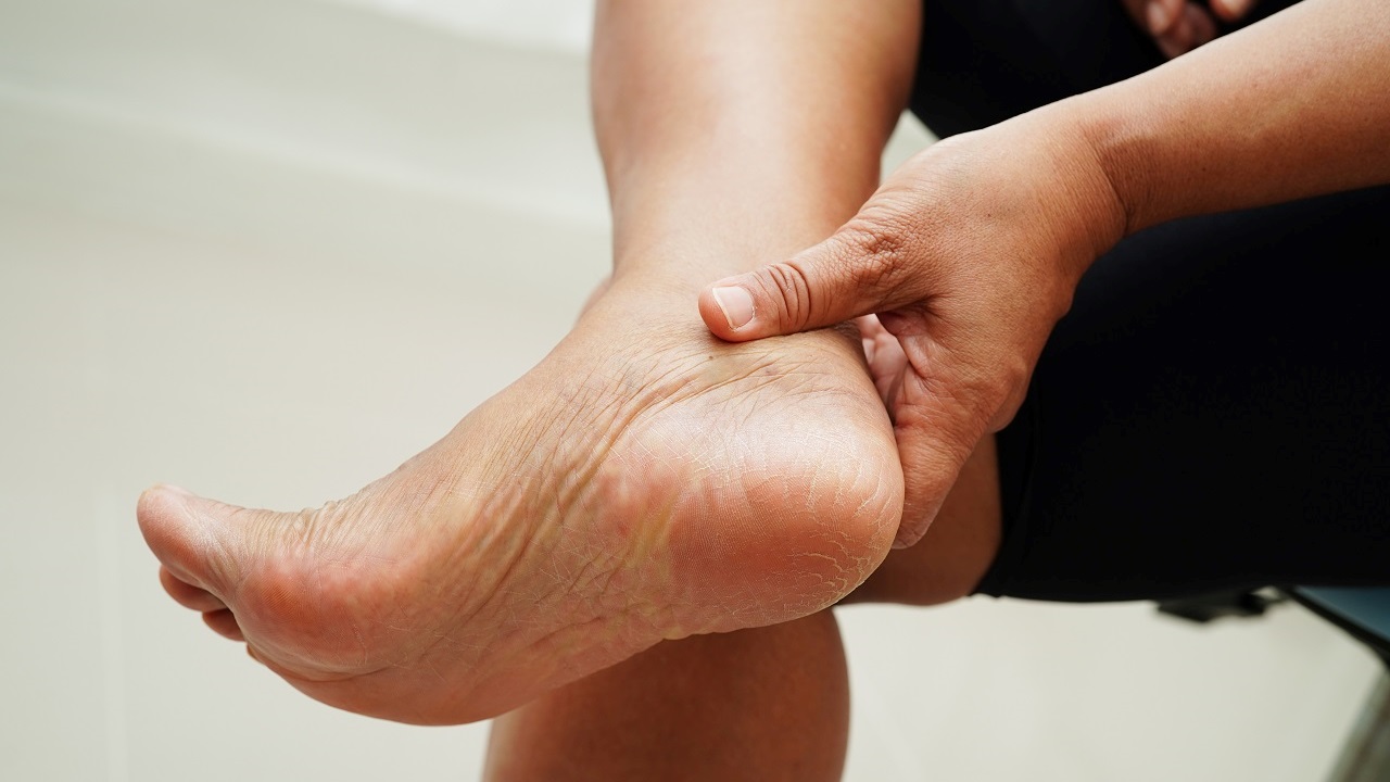 Rougeur anormale sur la plante des pieds