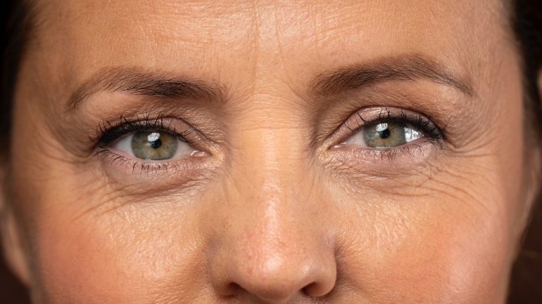 Rides du visage et soin naturel