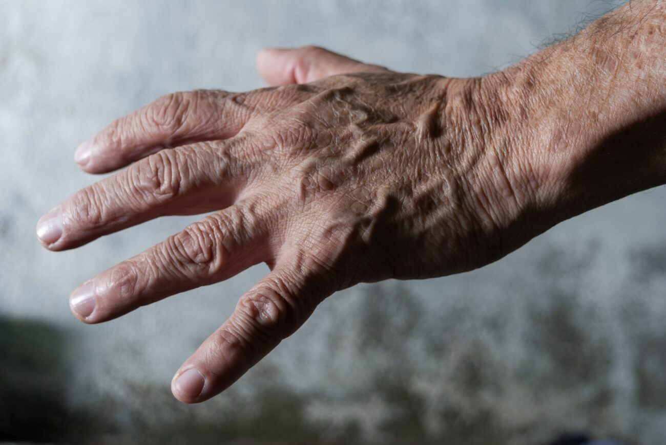 Veines très visibles sur les avant-bras