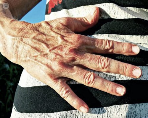 Jeune femme examinant ses veines