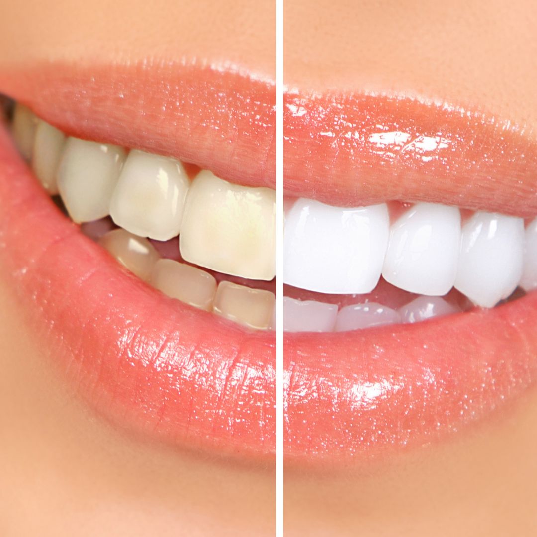 Préparation de dentifrice maison