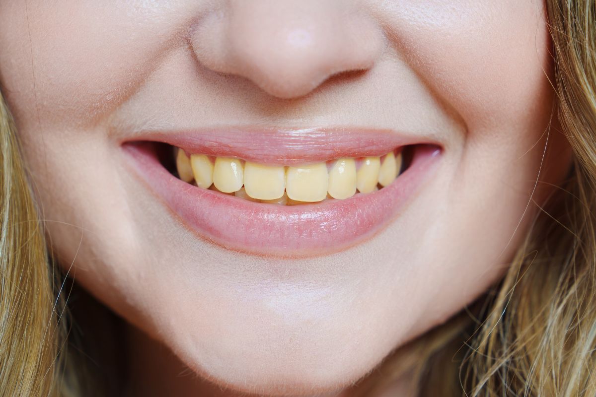 Importance de l'hygiène dentaire et soins des dents