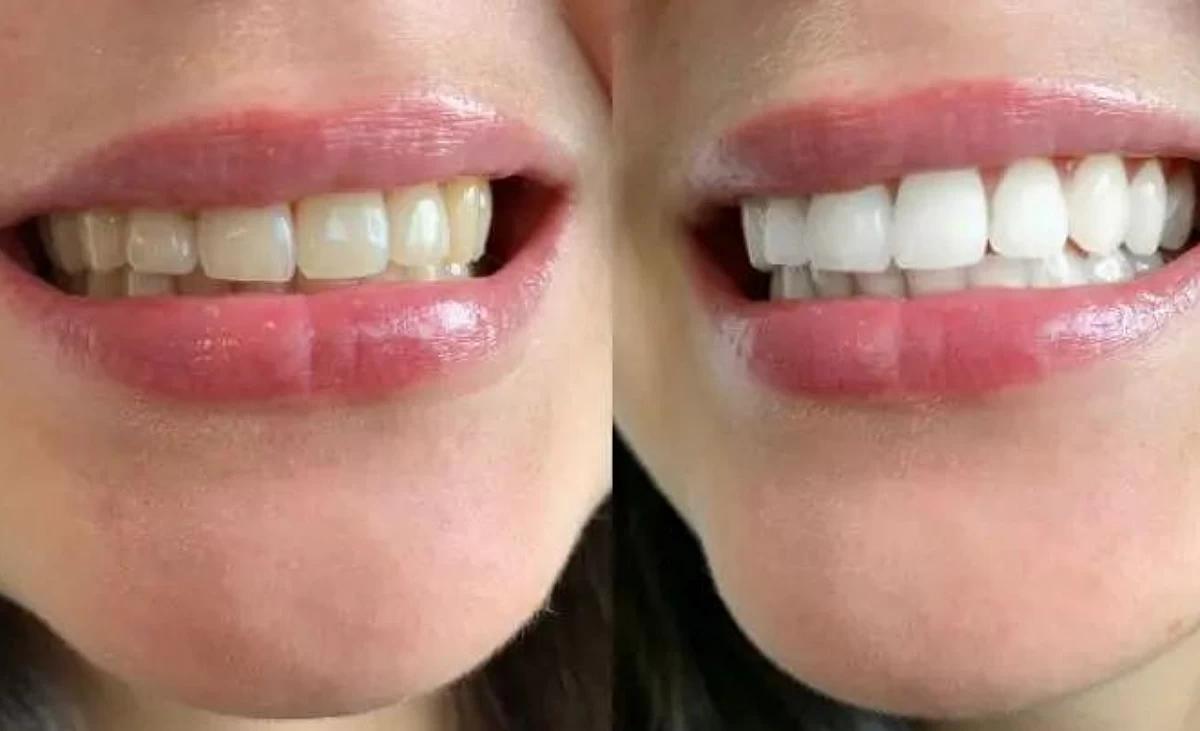 Sourire éclatant