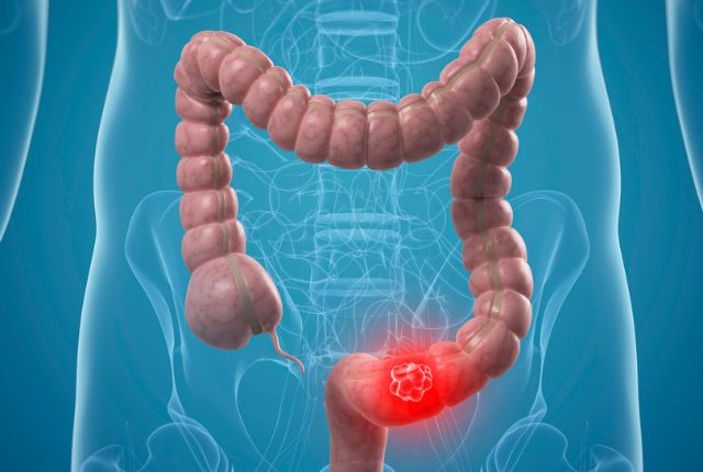 Médecin expliquant un diagnostic