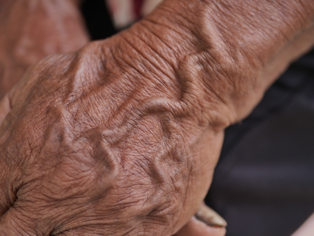 Veines marquées sur les bras
