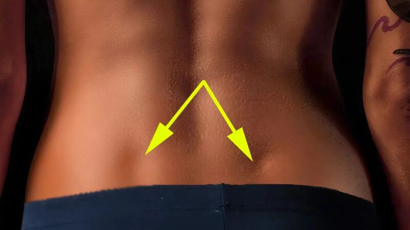 Fossettes lombaires chez une femme
