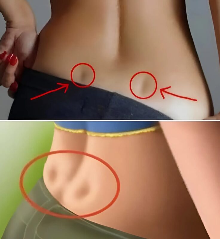 Anatomie des fossettes lombaires